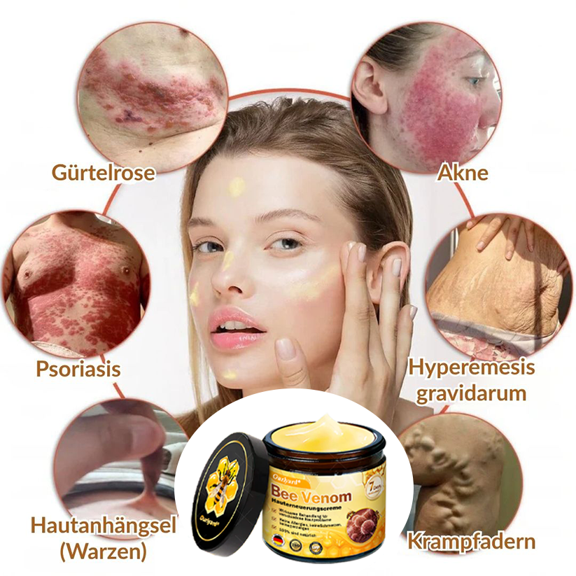 ✨✨Ourlyard® Bee Venom Skin Restoration Cream - 🔥Limited Time 80% OFF🔥