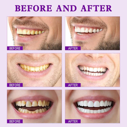 ✨Limited-Time 70% OFF Sale💜Purple Teeth Whitening Strips - Safe for Enamel