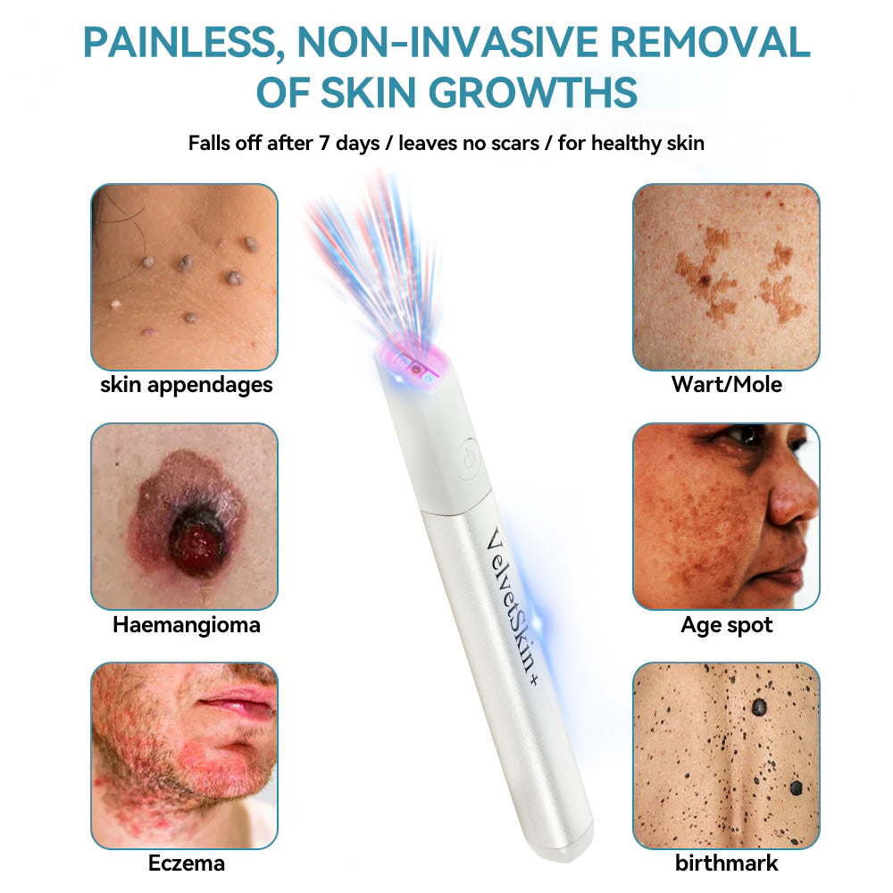 ☂DedMuller® VelvetSkin+Series ⚔️All-in-One Laser Eraser Pen🖊️ (🔬Powered by CO₂ laser technology – effectively removes moles, warts, skin tags, pigmentation spots, and other skin imperfections)