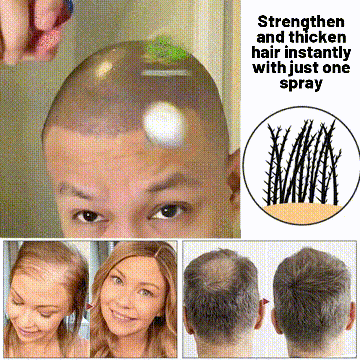 🌿AKTION ZUM LETZTEN TAG – 50 % RABATT🌿 HZA™ Natürliches Haarwuchsspray