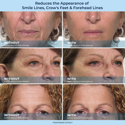 🔥Letzter Tagesverkauf: 49 % Rabatt auf LBMLBM-HOYGI™ 60-Sekunden-Anti-Aging-Serum gegen Falten, Tränensäcke und Augenringe