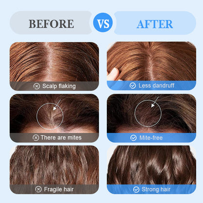 Oil-Control & Anti-Dandruff Shampoo