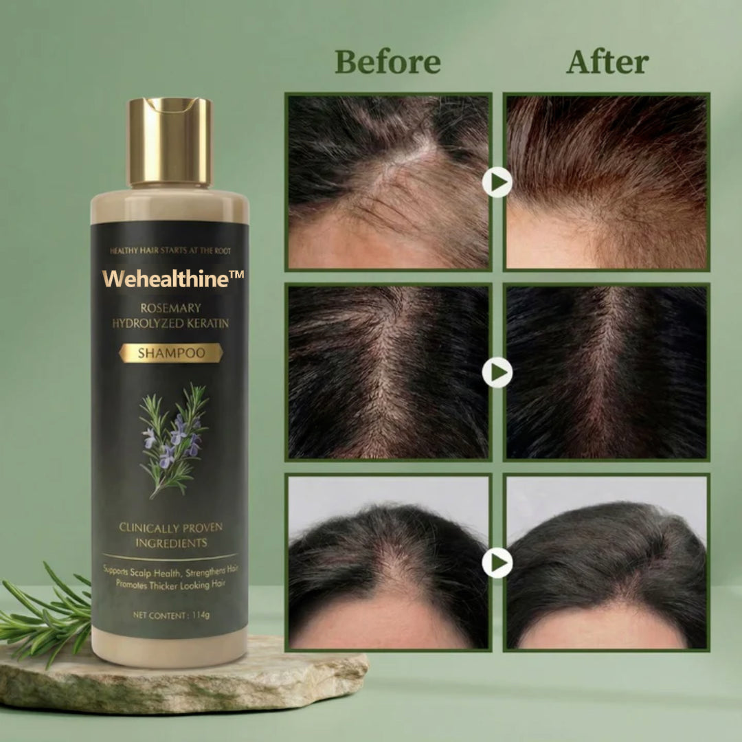 ✨Buy 1 Get 1 Free| Wehealthine™ Growth Support Shampoo