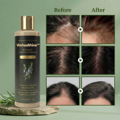 ✨Buy 1 Get 1 Free| Wehealthine™ Growth Support Shampoo